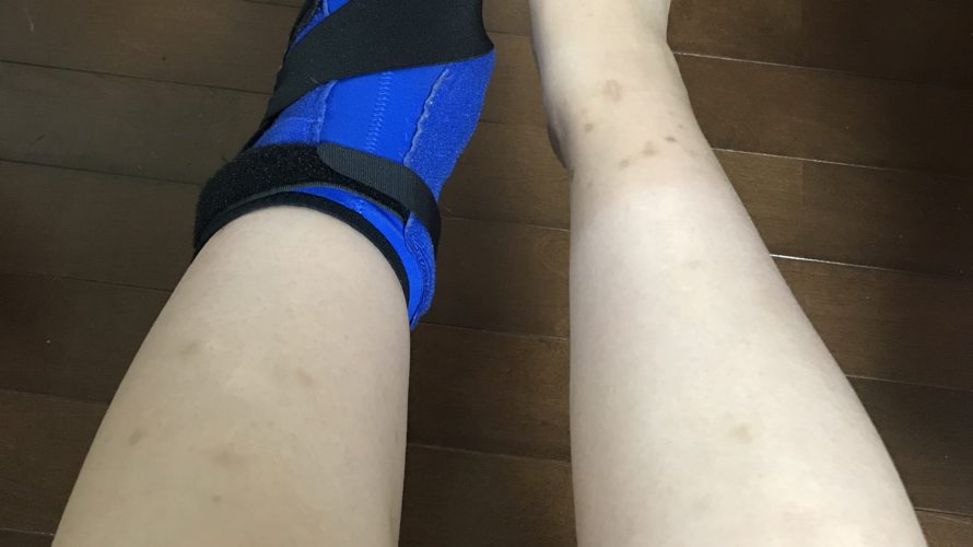 装具装着 骨折リハビリ 3分の1荷重 松葉杖 汚い足 アカだらけの足 30代主婦ダイエッターの日常